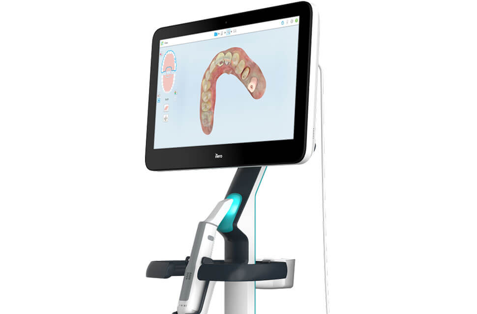 口腔内デジタルスキャナーによる精密な型取り