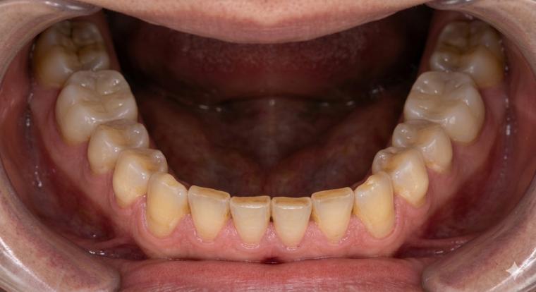 「無意識のクセ、直しませんか？」～鏡をのぞいて見つけるお口からのサイン