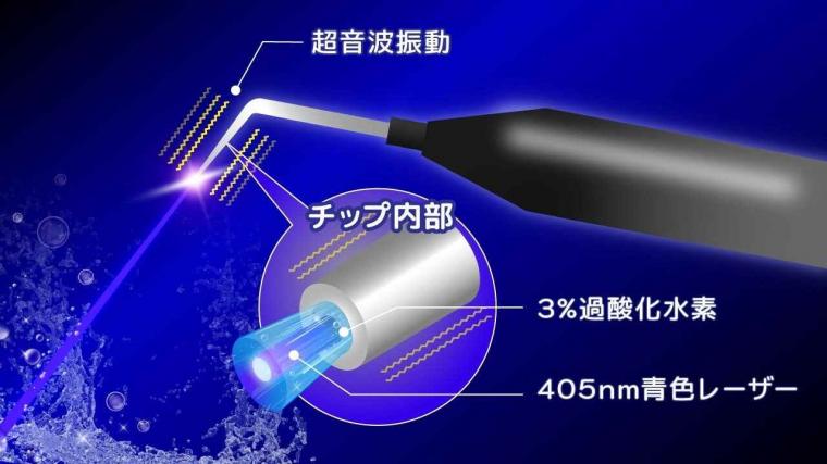 「もう抜くしかない」とあきらめる前に。「歯を残す」技術と毎日のケア